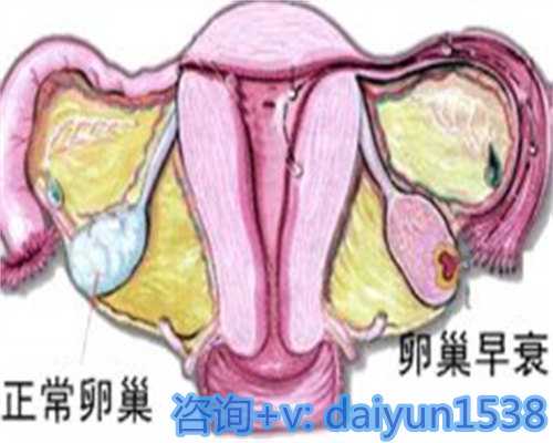 【北京家圆医院做供卵试管吗】顺转剖的感觉真是酸爽 北京供卵试管婴儿合法