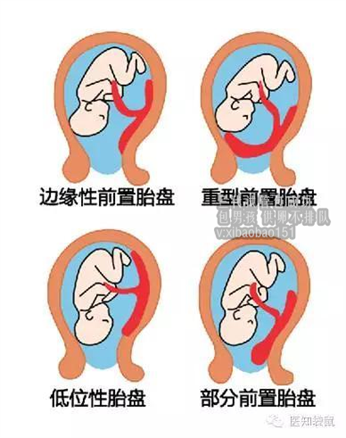 北京寻找捐卵女孩,美国精子库购买流程分享